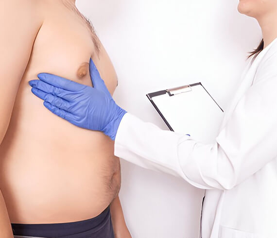 Gynecomastia Surgery Cost in Delhi - Dr Lokesh Handa -01